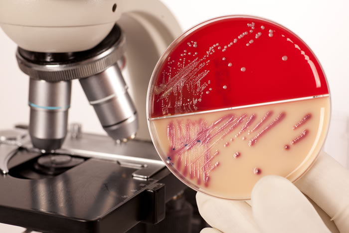 bacteria-microscope-petri-dish.jpg.423f55cb795e0f24f624ae7386fc69d8.jpg